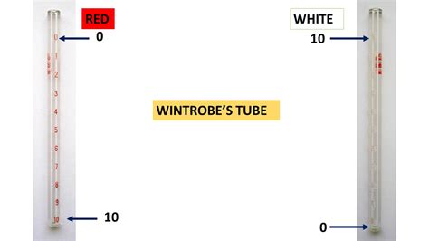 wintrobe's tube